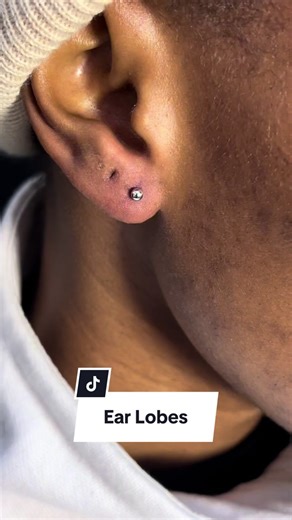 Piercing Second Ear Lobes: Experience and Pain Rating