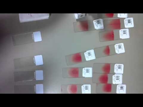 How to make blood slides