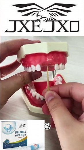 JxeJxo Moldable tooth repair kit Quick & Easy Fix for Broken Teeth but for temporary use only! #fix