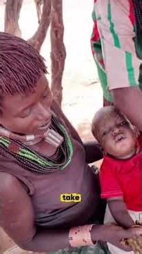 How the Hamer Tribe Treat Illness Without Modern Medicine 😲 Ancient African Healing Rituals