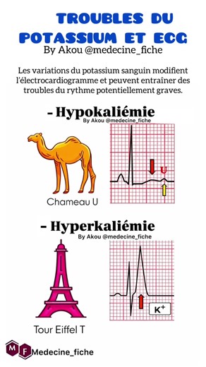 Troubles du potassium et ECG -Contenu à titre informatif. 📌Droits de Propriété et Protection: il est important de noter que ce contenu appartient à Medecine_fiche et est protégé par les droits de propriété intellectuelle. Tout usage non autorisé ou reproduction de ce contenu est strictement interdit sans mon consentement explicite. Je tiens à préserver l'intégrité de mon travail et à protéger mes droits en matière de propriété intellectuelle.
