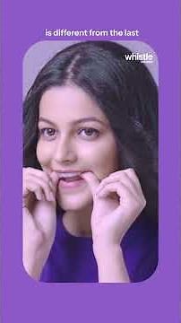 How Do Whistle Aligners Work? | Clear Aligners Explained by an Orthodontist