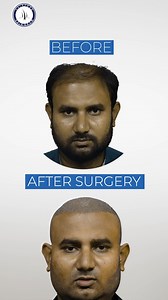 5.7K views · 11 reactions | Let’s make sure your hair restoration...