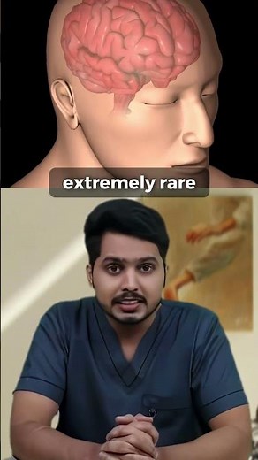 This Rare Skin Condition Looks Like a Brain—And Doctors Can’t Explain It