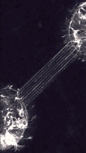 This is how neurons form synapses #viral #neuroscience