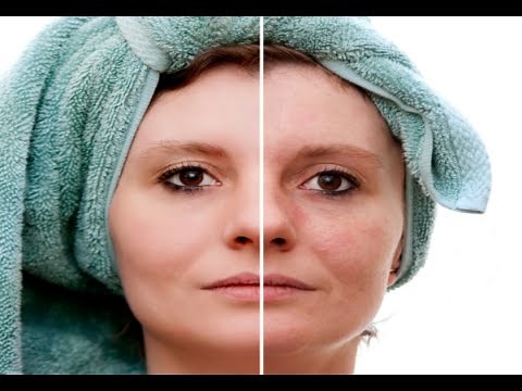 How to Remove Age Spots on Face - Dark Spots On Skin