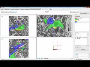 ilastik 0.5: Seeded Watershed on 3D Images
