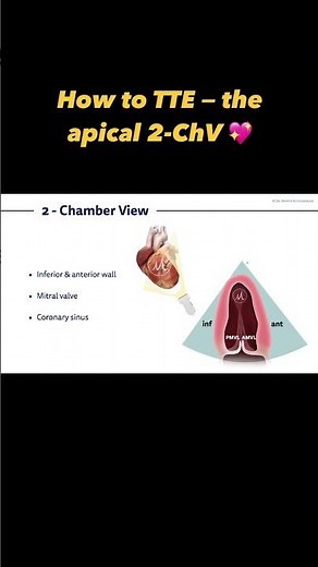 How to TTE - the apical 2-ChV #ultrasound #echocardiography #cardiology