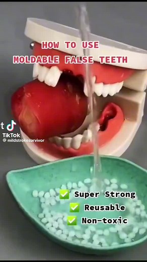 How to Use Moldable False Teeth: Step-by-Step Tutorial