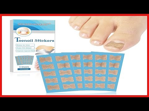 Toenail Corrector Patch, Ingrown Toenail Correction Stickers, Glue-free Ingrown Toenail Corrector
