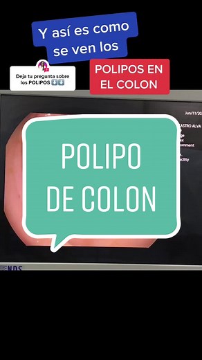 #Pregunta de @dra.veronica.gastro