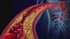 Moderate exercise can reverse and restore a stiffening heart muscle