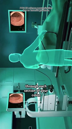 Colonoscopy Procedure!!(3D Animation)