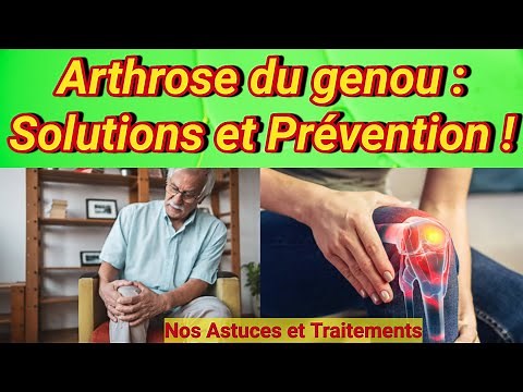 Knee Osteoarthritis: Symptoms, Treatments and Practical Advice for Living Better.