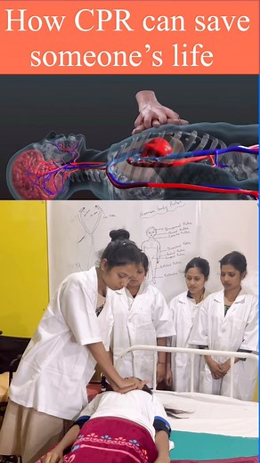 💓 How CPR Can Save Someone’s Life! 💓 Learn how quick action and simple CPR steps can bring a person back to life during an emergency. 🚑 Watch this video to understand the importance of CPR, when to do it, and how it works to keep the heart and brain alive until medical help arrives. #CPR #FirstAid #SaveLives #HealthSector | Surajit Tripura