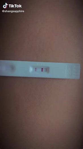 Congenital Anomaly Scan at ₱3,500 with Free Frame