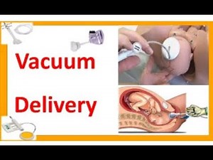 Vaccume delivery complete lecture