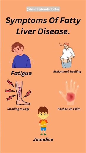 Top 10 Warning Signs Of Fatty Liver Disease | Fatty Liver Signs You Should Not Ignore! | Fatty Liver