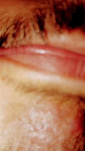 #shortsyoutube #salon #ingrownhair #beard #shorts #satisfying #asmr