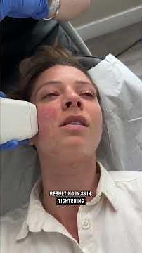 A facelift without needles? Sofwave™ is the secret to tighter, smoother skin.
