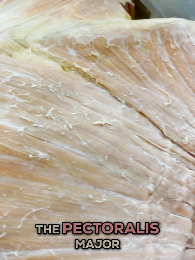The Pec Major: One of the Most Beautiful Muscles in the Body 💪 Check out the pectoralis major—a stunning fan-shaped muscle that spreads across your chest and converges onto the humerus. But here's what makes it even cooler: it's actually made up of 2-3 different heads (or parts)! The Heads of the Pec Major: 🔹 Clavicular Head – Originates from your clavicle (collarbone) 🔹 Sternocostal Head – The larger section coming off your sternum and ribs 🔹 Abdominal Head – Not everyone has a prominent on