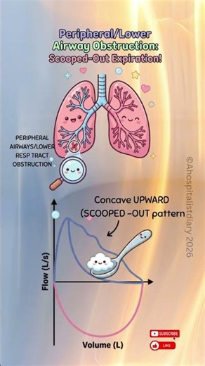 Master PFTs in 3 Minutes: Peripheral/Lower Airways Obstruction Loop: SCOOPED-OUT COVED#usmle #shorts