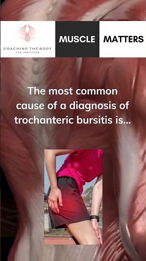 Hip Bursitis Explained: True Hip Pain Cause and Treatment
