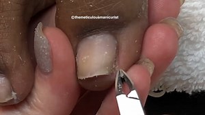 Pedicure Deep Toe Nails Cleaning at Home . . . In today's tutorial, you will learn how to deep clean your toenails and give a pedicure at home to give yourself ingrown toenail relief. People often confuse pain on the sides of the toes as ingrown toenails but often times you just need a deep toenail cleaning to remove all the buildup skin to give relief. I am going to show you how to do that so stay tuned. 👇 Online Store 🙌 http://bit.ly/pedicuresupplies My Nail Channel 👣 http://bit.ly/nailacad