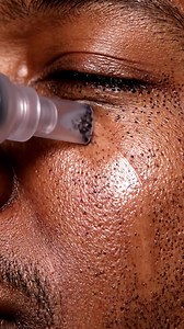 Welcome to a deeply relaxing ASMR blackhead removal experience. In this whisper-soft skincare session, enjoy ultra-realistic 4K close-up shots as blackheads gently lift out using a professional pore vacuum. Every sound is captured intentionally—soft suction, gentle tool movements, calming breathing—designed to give you tingles, relaxation, and pure satisfaction. This ASMR facial cleaning video is completely clean, safe, non-graphic, and fully monetizable. No popping, no harsh pressure, no blood—
