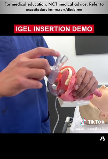 2nd Generation LMA insertion demo #laryngealmaskairway #airway #difficultairway #anesthesia #anesthesiologist #supreme #igel #proseal #anaesthetist #CRNA #insertion #demo