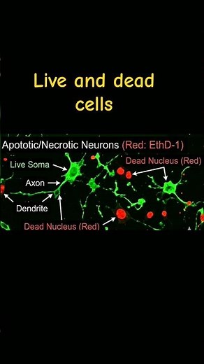 live and dead cells imaging using confocal microscope #imaging #confocal #microscopy #cell #shorts