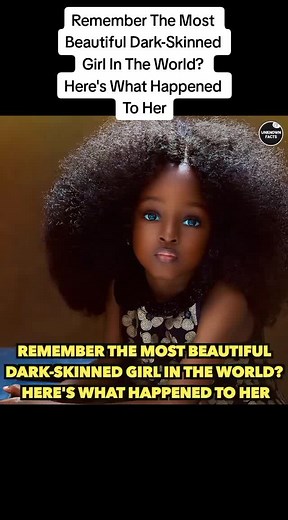 Remember The Most Beautiful Dark-Skinned Girl In The World? Here's What Happened To Her #fypシ #fypage #fy #fypシ゚viral #fypdongggggggg #fyppppppppppppppppppppppp #fypdong #fypp #fypgakni #fypsounds #viral #viralvideo #viraltiktok #viral #trend #trendy #trendingvideo