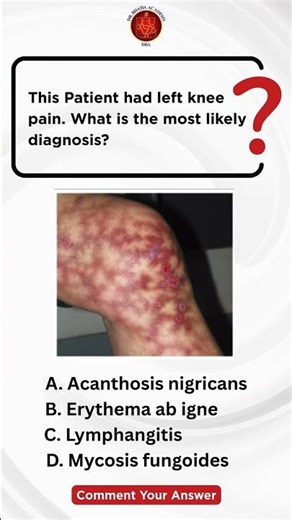 Only Sharp Minds Will Get This Right! 🧠💡 | Clinical Diagnosis Challenge
