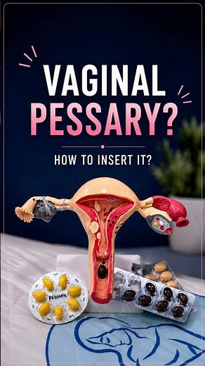 Vaginal Pessary? Here’s How to Insert It