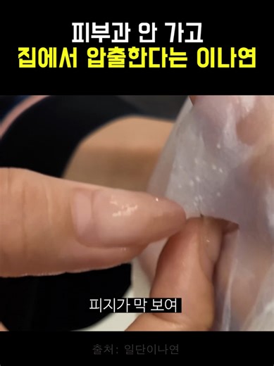 이나연 압출팩으로 피부 관리하기