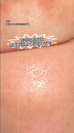 ⚠️閲覧ご注意【VT COSMETICS / ブイティー】新作レチナール ペプチド シリーズ３点と既存品のリードルショト100と300のお品のご紹介です💁‍♀️