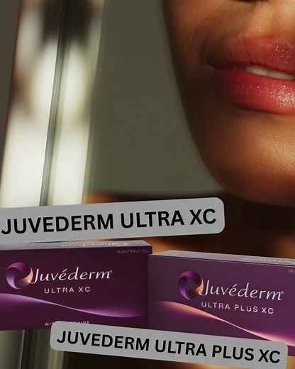JUVEDERM ULTRA XC