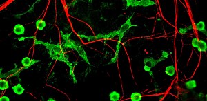 Harnessing the brain’s immune cells to stave off Alzheimer’s and other neurodegenerative diseases