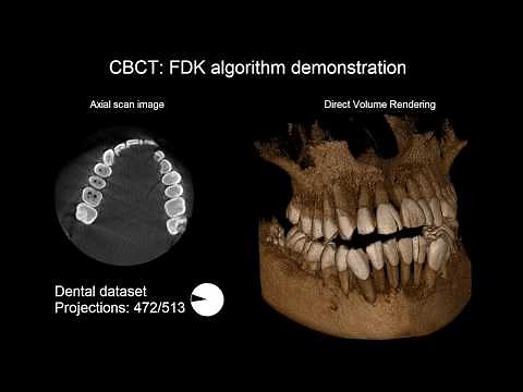 FDK algorithm demonstration
