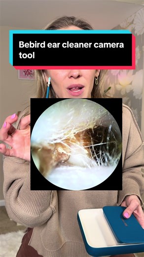 If you get built-up wax in your ears, you have to try this ear cleaner camera tool! It’s so only satisfying @Bebird Official #tinnitus #bebird3ultra #SmartEarCareDevice #VisualEarScoop #HummingbirdBebird
