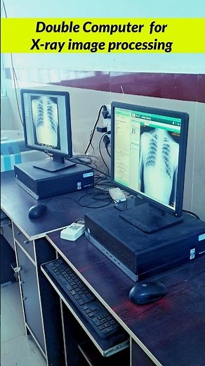 Fujifilm CR System Digital X-ray machine #radiographerusn #xray