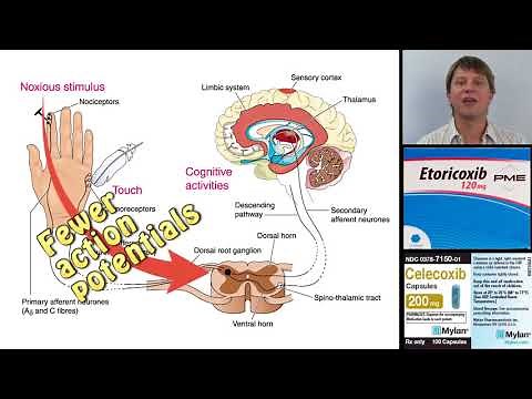 Etoricoxib, celecoxib and other COX 2 specific NSAIDs