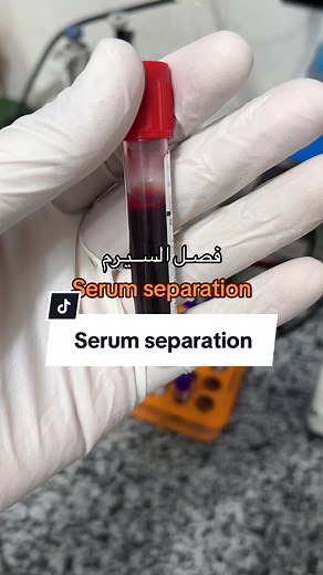 Serum Separation Techniques in the Lab