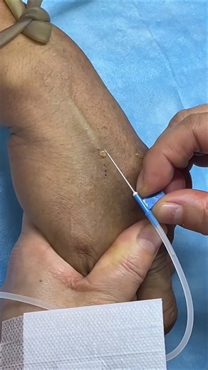 How to Give IV Injection Safely | Step-by-step Intravenous technique |perfectly IV & IM injection💉31