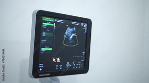 Doctor operating Ultrasonography (USG) tools for pregnant woman