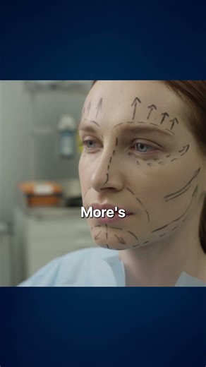 Dr. Bill Burden on why "less is more" in surgery. ✋ Natural results = knowing when to stop.