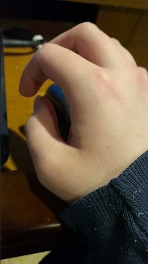 Thumb muscle twitching BFS