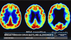 Breakthrough drug in the battle against Alzheimer's disease