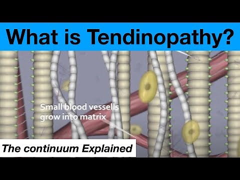 Tendon Pathophysiology