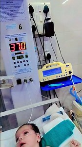 New Admission New born male baby Required o2 Mild RDS